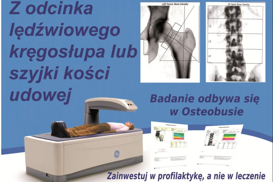 BADANIE OSTEOPOROZY
